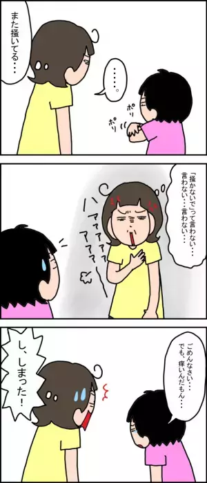 「寄り添って」と言われても…ストレスでからだを掻きむしる娘。解決策が見つからない、試行錯誤の毎日