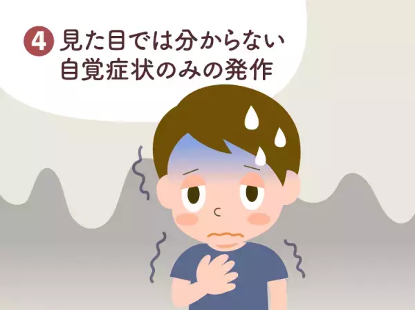 てんかん（癲癇）とは？原因や発作のパターンをイラストで詳しく解説。4つの診断の種類なども【医師監修】