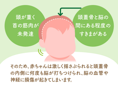 SBS による合併症