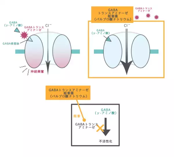 てんかんの治療薬、デパケン（バルプロ酸ナトリウム）とは？どんなてんかん発作に処方される？効果や副作用、ほかの治療薬についても解説【てんかん専門医監修】