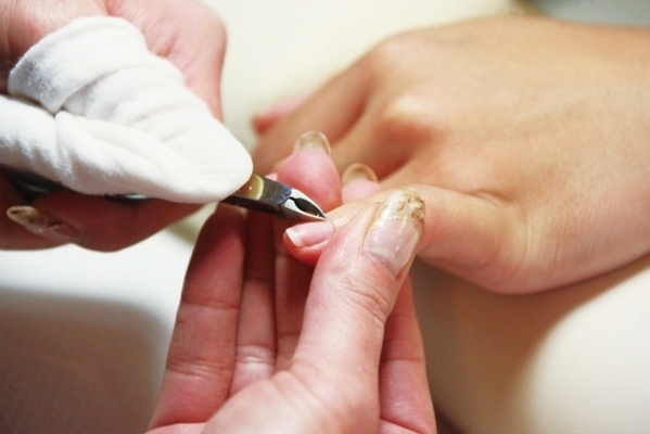 爪がガクガク？伸ばしすぎな方は要注意！爪甲剥離症の注意・ポイント４つ