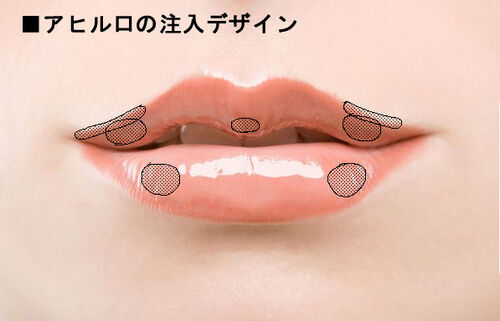 美容整形外科医が教える！「魅力的な唇」３つの条件とは？