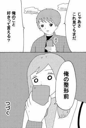 「モデル級イケメンの彼氏に実は整形してる、と打ち明けられたら」前編