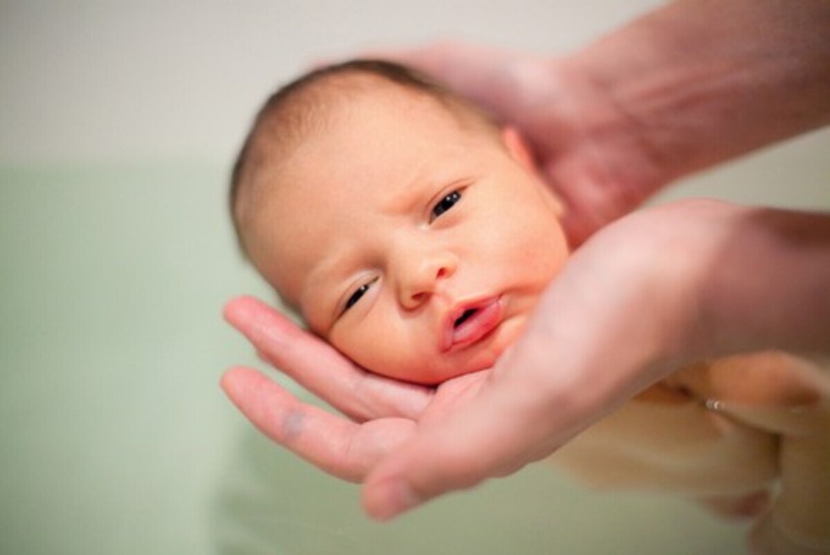 1週間超えたら要注意 医学博士が語る 赤ちゃんの生理的変化 新生児黄疸 の特徴 16年4月5日 ウーマンエキサイト 1 3