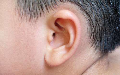 医学博士に聞いた 子どもの耳の鼓膜が破れた時 どうしたらいい 17年5月30日 ウーマンエキサイト 1 2