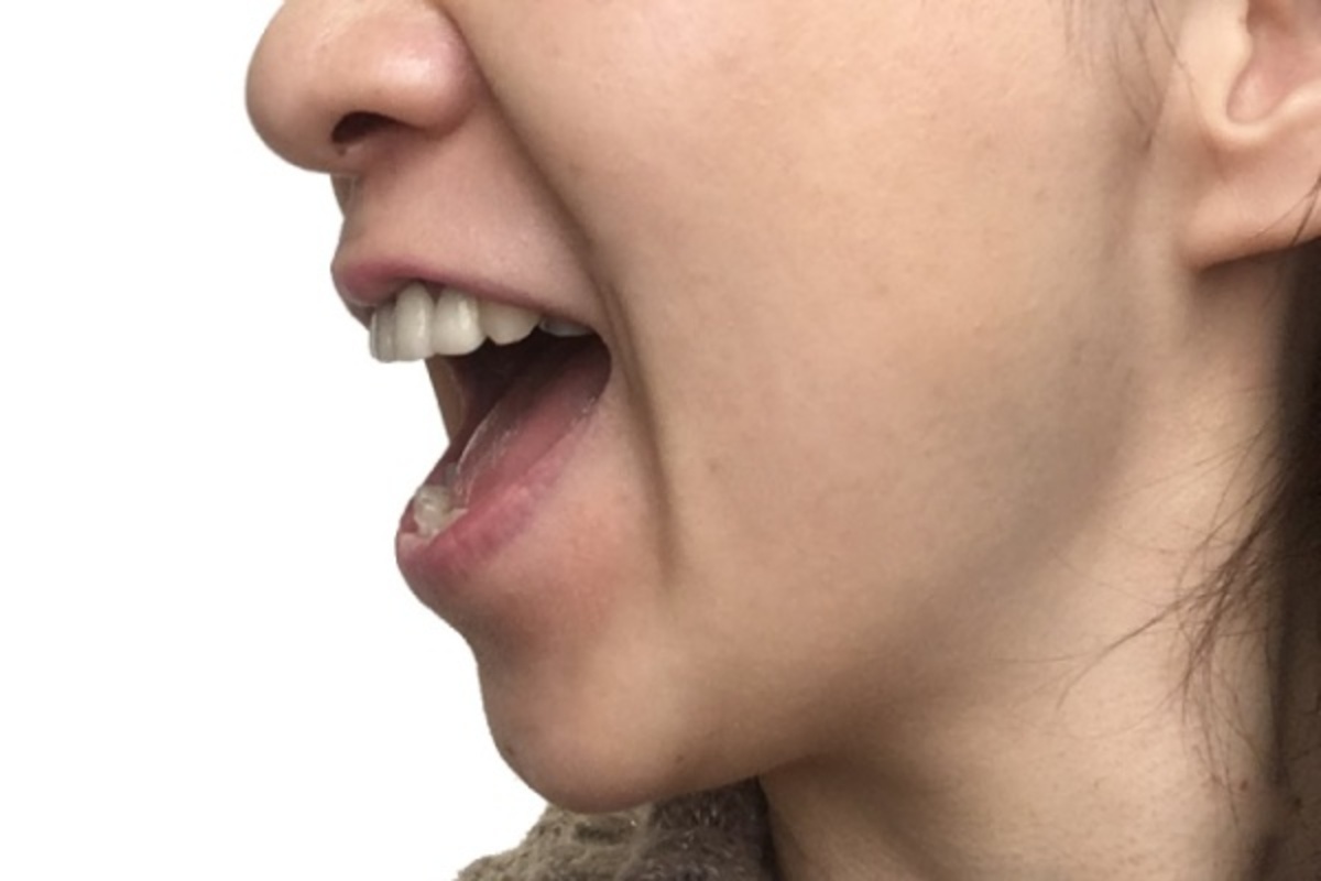 口呼吸を鼻呼吸に矯正する顔の体操と口テープのやり方 ウーマンエキサイト 1 3