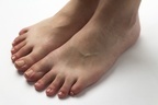 女性の8割抱える「足の浮き指」、不調招く可能性を医師が指摘