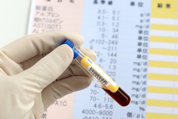 唾液や血液、尿でわかる！最新「お手軽がん検診」のお値段