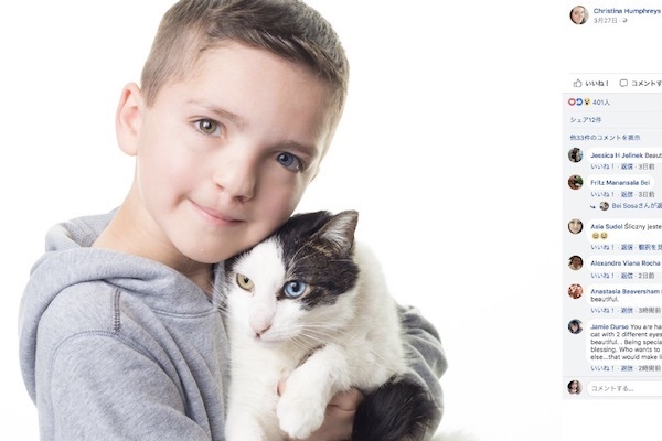 ヘテロクロミアの少年をいじめから救った“おそろい”の猫