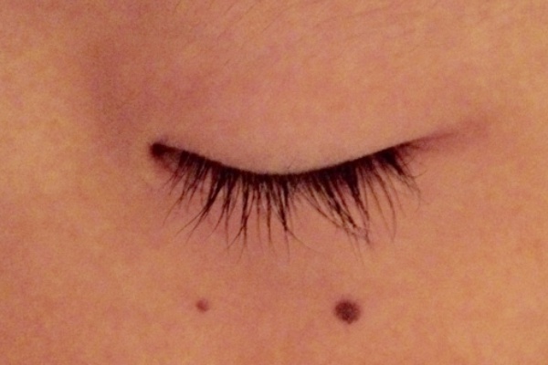 望診カウンセラーが伝授「ホクロで内臓のSOSがわかる」