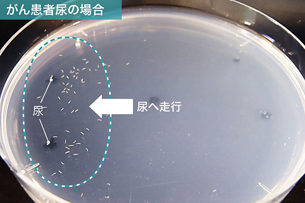 9800円で全身をがん検査、「線虫」が拓くがん想起発見の道