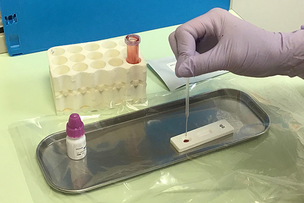 新型コロナ抗体検査　陽性で免疫ある証明に？　医師の見解