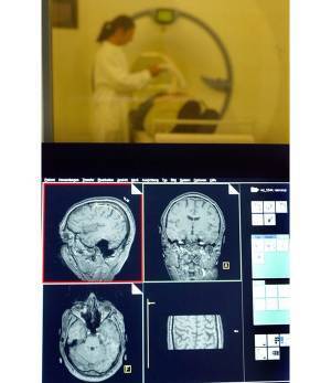 脳炎から認知症になる可能性も　専門家危惧するコロナ後遺症