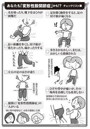 家族が気づくことも「変形性股関節症」の予兆と防ぐ生活習慣