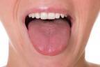 1日3分舌はがし　口呼吸改善で頭痛不眠たるみも解消