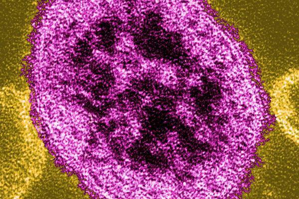 50歳以上は特に注意…肺炎や脳炎引き起こす「はしか」の恐ろしさ　茨城、東京に次ぎ神戸でも感染確認！