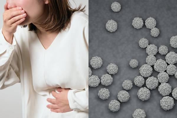 ノロウイルス感染の危険、血液型O型の人はB型の10倍も！