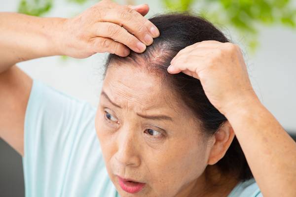 白髪、薄毛、うねり……女性の髪トラブルを美髪に復活させる若返りホルモン『マイオカイン』って？