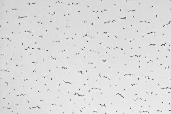 「虫みたい」とSNSで話題の病院の天井、なぜこの柄？建材会社が明かした“メリット”