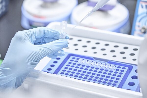 《ステージ0の肺がん見つけた事例も》検尿で判定「お手軽がん検査キット」が話題