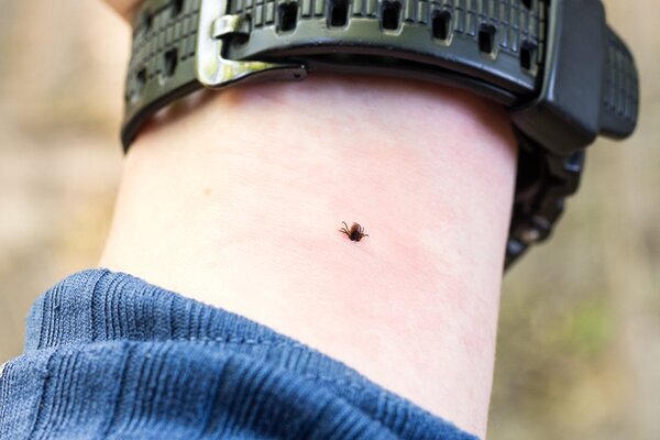 致死率は10～30％、全国に拡大…“マダニ感染症”の「簡単な見分け方」と身を守る服装