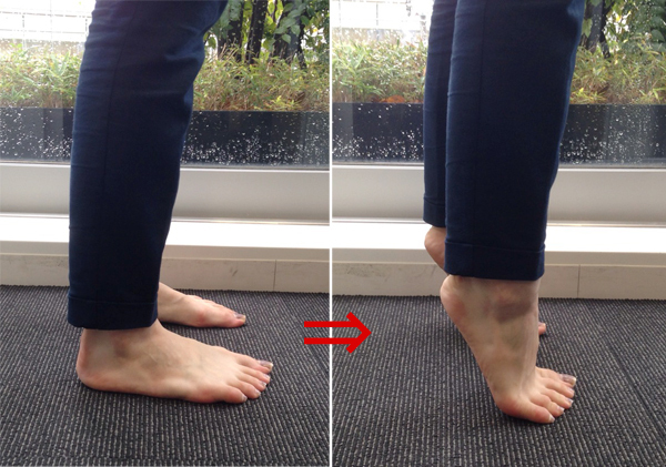 むくみの原因は “冷え” じゃない？！ 知っておきたい “静脈の病気” とは