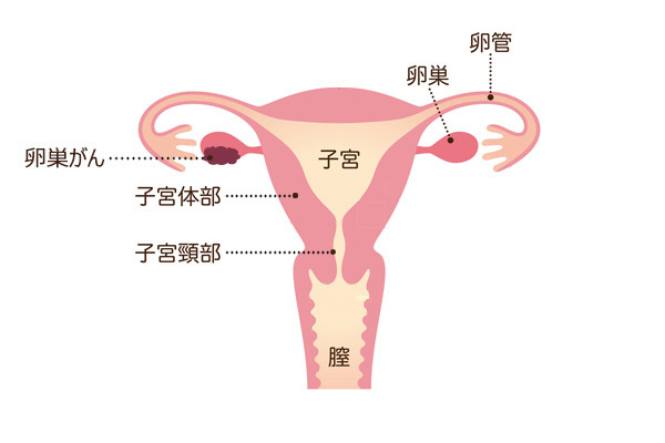 知らなかった、では遅い！ アラフォー女子が受けるべき「がん検診」