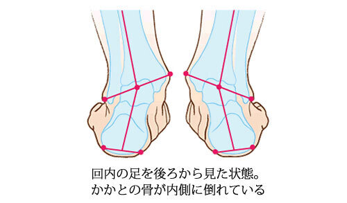 目からウロコ！　ブーツを快適に履くために、覚えておきたい冬のフットケア