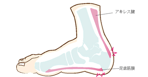 その靴が足をダメにする?！ アラフォーからの正しい靴の選び方