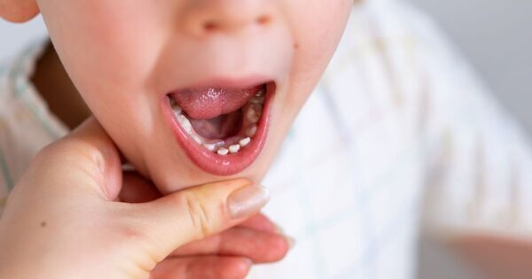 【歯科医師監修】子どものデンタルケアの基礎知識——賢い親が知っておくべき5つのこと