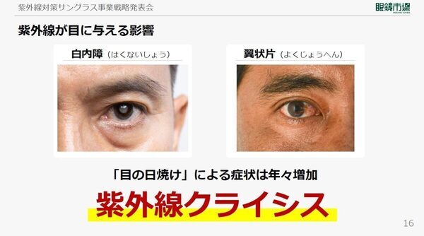 「子どもの目の紫外線対策は、早ければ早いほうがいい」眼科医が警鐘を鳴らす理由