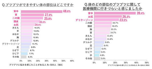 からだのブツブツ、女性の6割がトラブルが気になるまでケアしないと回答。その理由は？