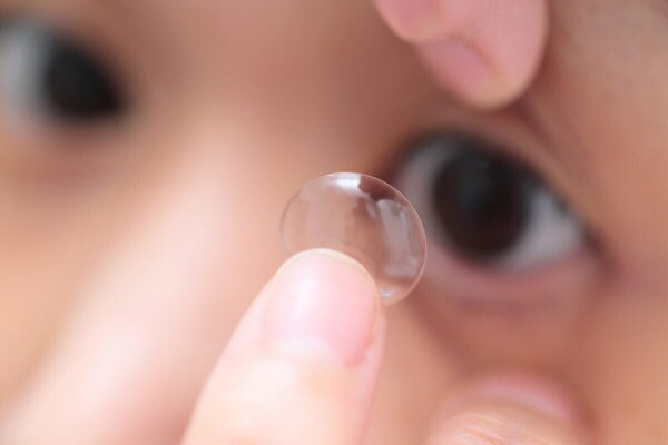 「子どもの近視は放っておかない」が新常識に！ 日本初、コンタクトレンズによる最新治療がスタート