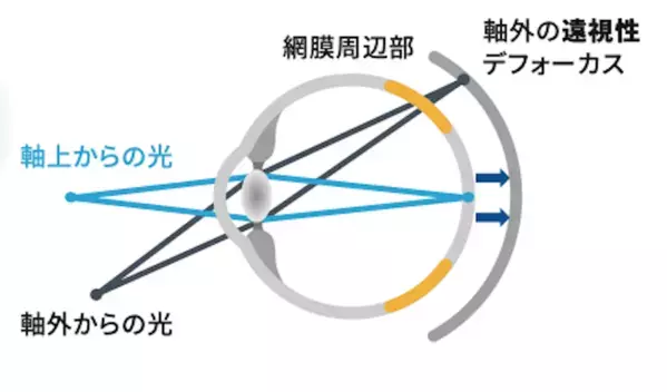 デジタルを完全にやめることはできない時代だからこそ。子どもの近視の傾向と日常でできる対策を知っておく