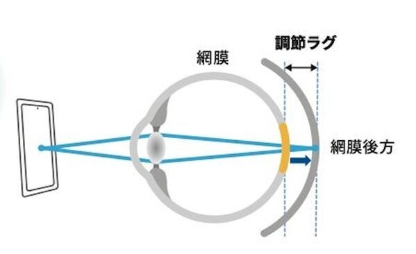 デジタルを完全にやめることはできない時代だからこそ。子どもの近視の傾向と日常でできる対策を知っておく