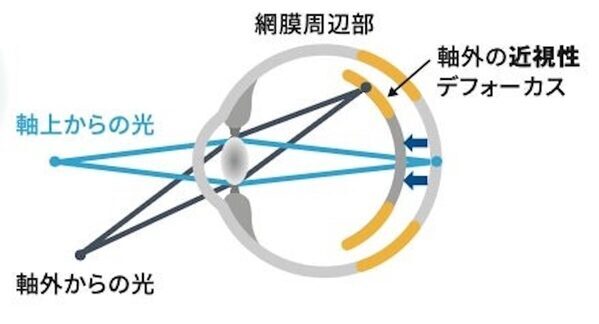 デジタルを完全にやめることはできない時代だからこそ。子どもの近視の傾向と日常でできる対策を知っておく