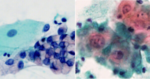 【無料】「自分の細胞が見られて楽しい」 幕張メッセで開催「細胞アート展」のワークショップがすごすぎる！