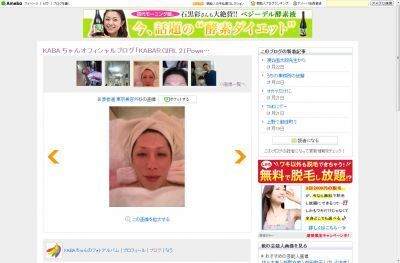 KABA.ちゃん、美への追求止まらず、また整形！