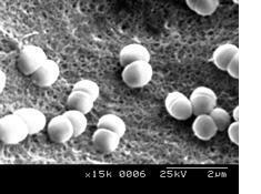 トマトのお漬物でおなかすっきり？