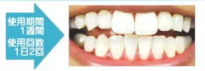 鏡の前で笑ったらわかる！ あなたを不幸にしているアレのケア方法とは？