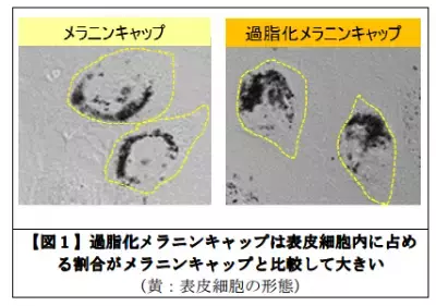 シミが頑固になるのはメラニンキャップが過脂化するのが原因！