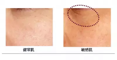 気づかずやっているこんなことが目元の｢影ジワ｣｢くすみ｣につながる