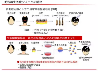 脱毛症治療の再生医療技術・製品を3者が共同研究すると発表
