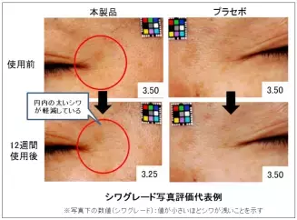 シワを改善する製品って？来年発売予定！
