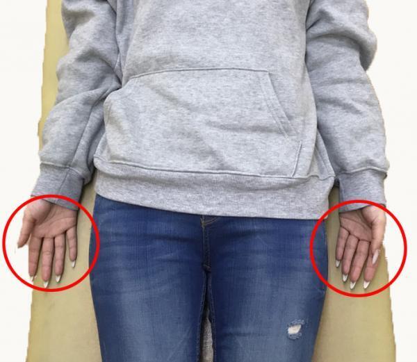 女性の綺麗は姿勢から！「美-Body」猫背矯正メニュー