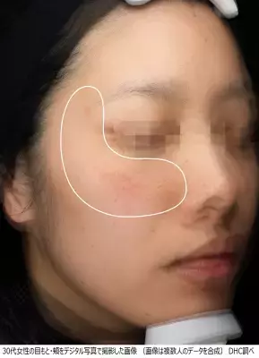 7歳老けて見えるCゾーンのシミ、できる前からのケアが重要