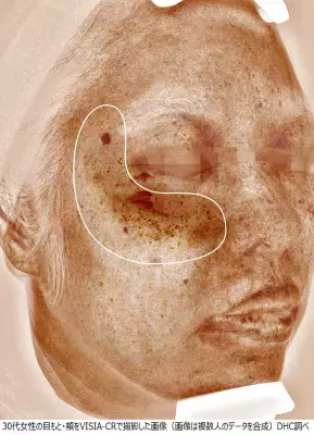 7歳老けて見えるCゾーンのシミ、できる前からのケアが重要