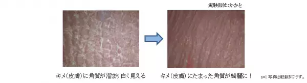 珊瑚の力でツルツルに！ボディスクラブ登場。