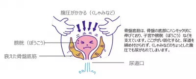 花粉シーズンはUI(尿もれ)に注意！今からできる予防法と対策とは？
