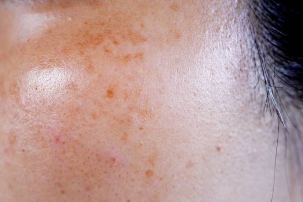 資生堂のdプログラムよりオールインワン薬用美白ジェルが数量限定発売！